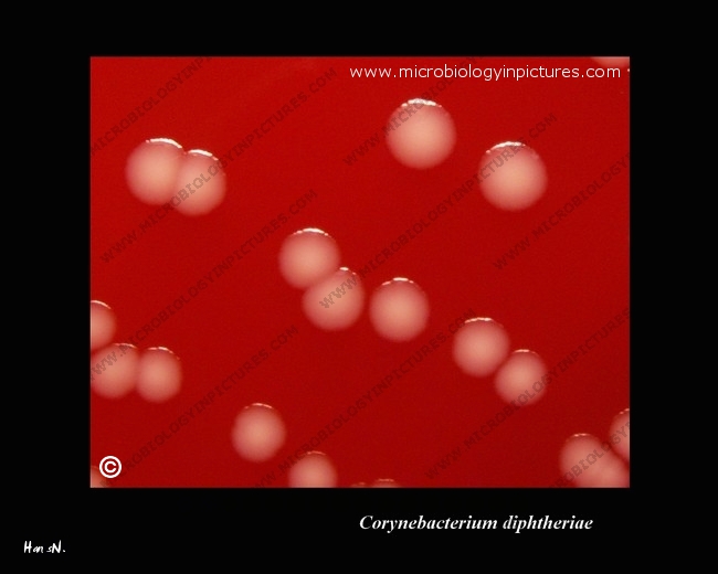 corynebacterium diphtheriae colony close-up